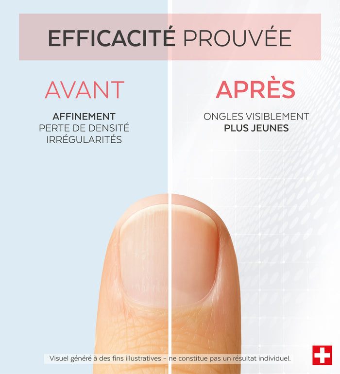 Efficacité prouvée avant après du sérum concentré collagène Poderm
