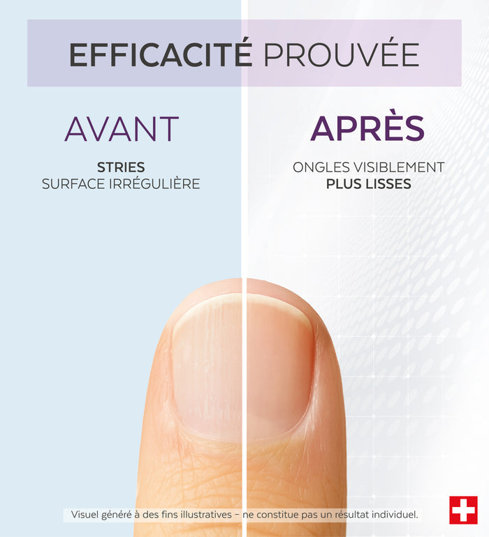 Efficacité prouvée avant après du sérum concentré bakuchiol Poderm