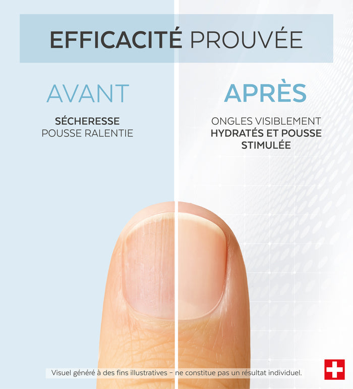 Efficacité prouvée avant après du sérum concentré D-panthénol Poderm