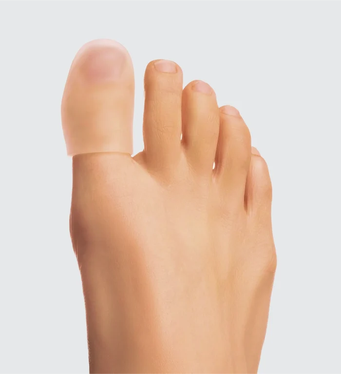 Capuchon de protection mycose de l'ongle Poderm porté sur le gros orteil