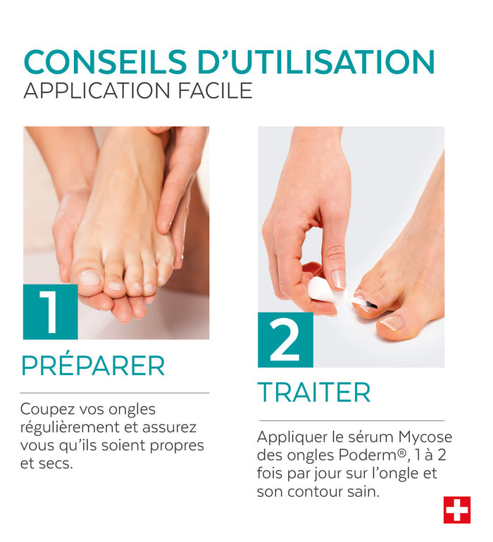 Duo Sérum Mycose des Ongles