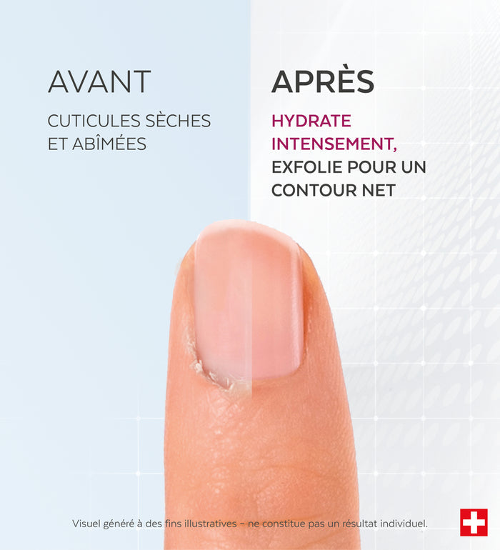 Application du gel émollient cuticules Poderm sur le contour des ongles