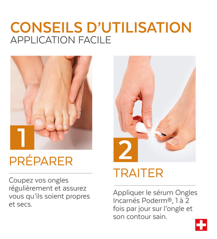 Mode d'emploi du sérum ongle incarné Poderm application 2 fois par jour
