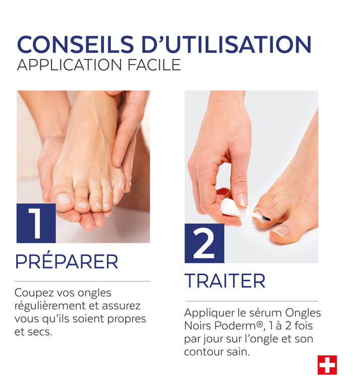 Mode d'emploi du sérum ongle noir traumatisé Poderm application 2 fois par jour