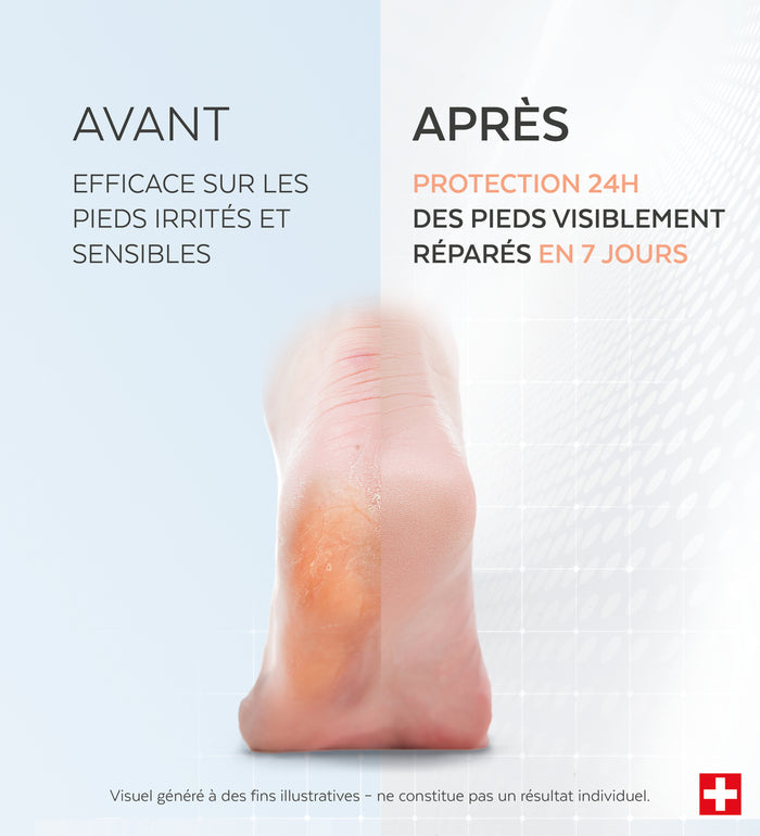 Résultats avant-après du sérum pieds irrités et sensibles Poderm