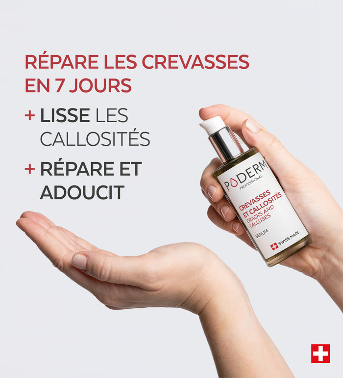 Bénéfices du sérum crevasses et callosités Poderm pour la nuit