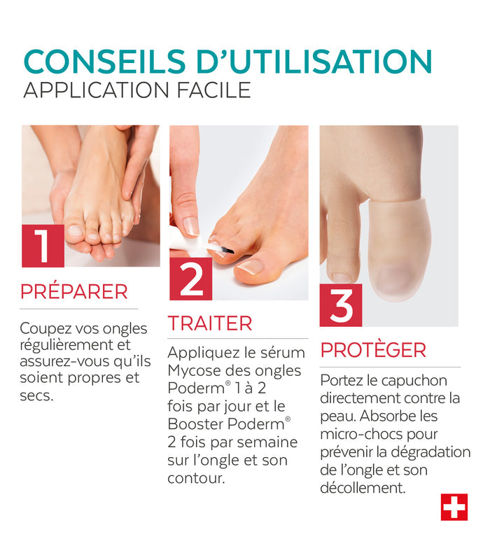 Trio Capuchon - Mycose des ongles