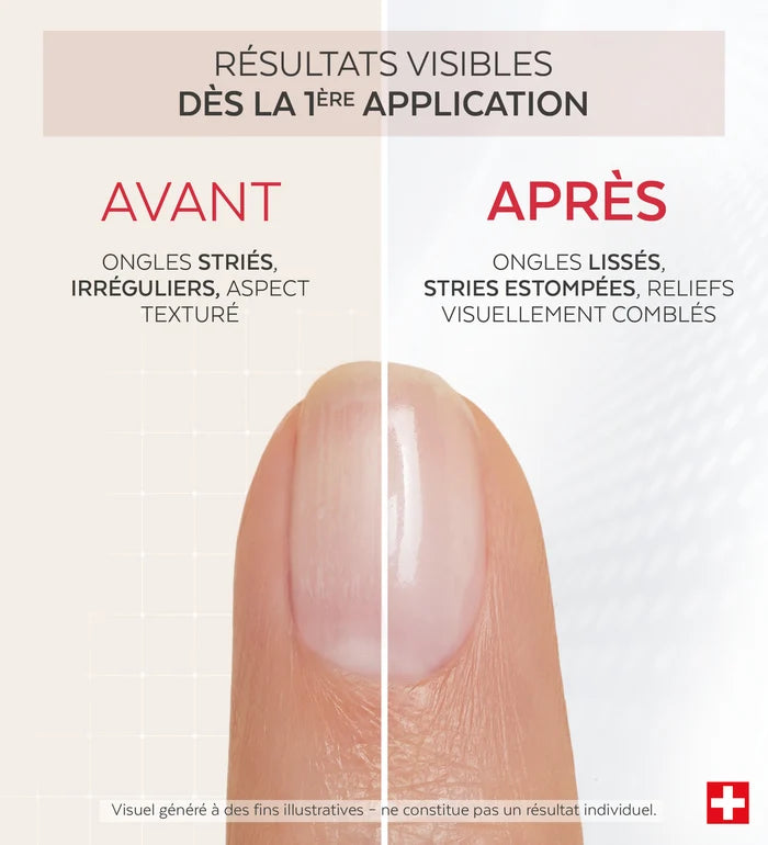Résultats avant après du vernis Nail Corrector comblant collagène Poderm dès la 1ère application