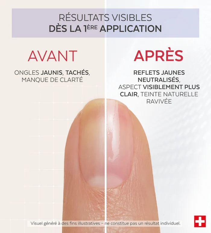 Résultats avant après du vernis Nail Corrector déjaunissant citron Poderm dès la 1ère application