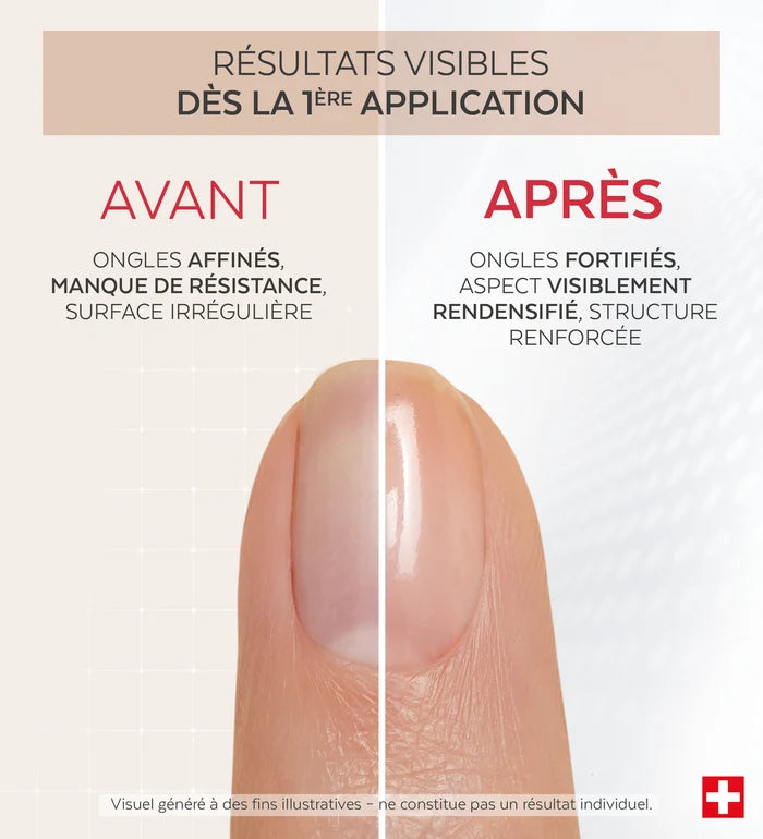 Résultats avant après du vernis Nail Corrector redensifiant kératine Poderm dès la 1ère application